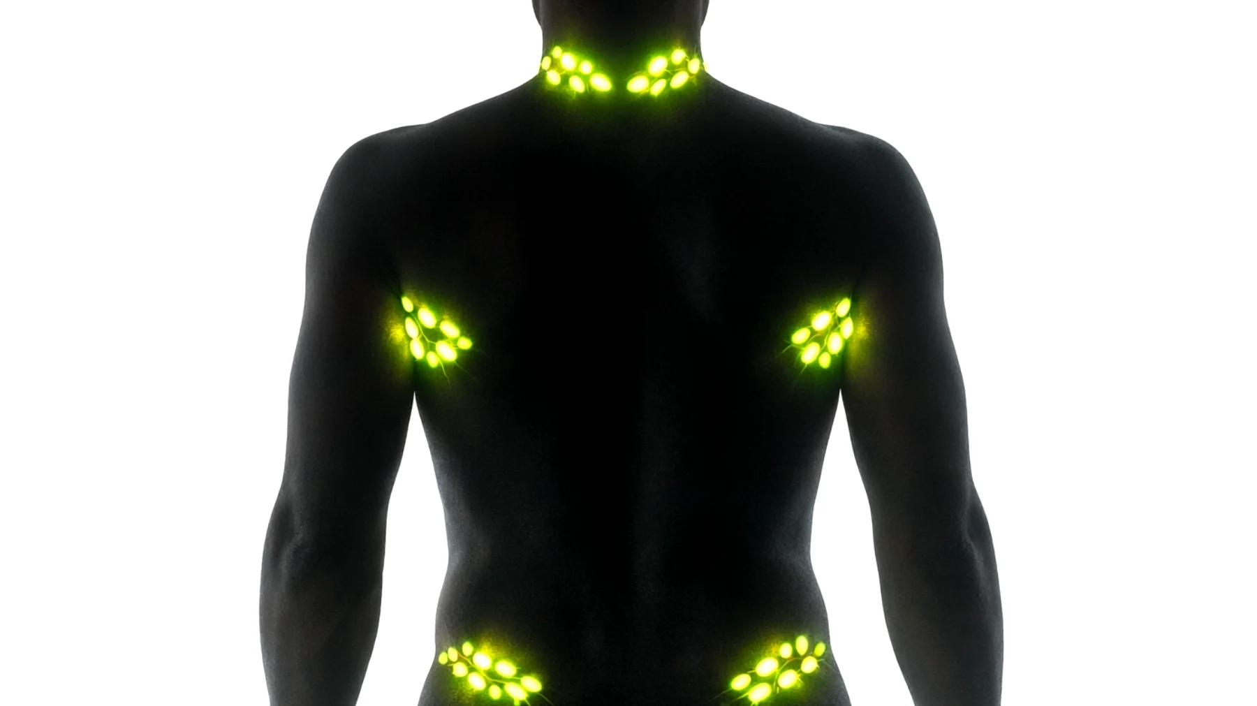 Il linfoma è una patologia oncologica che colpisce il sistema linfatico e che spesso viene sottovalutata o confusa con altre condizioni. Molte persone non conoscono i sintomi più comuni che possono segnalare la sua presenza, come il gonfiore dei linfonodi, la febbre persistente, la sudorazione notturna e la perdita di peso inspiegabile. Identificare precocemente questi segnali è fondamentale per aumentare le possibilità di una diagnosi tempestiva e di un trattamento efficace."